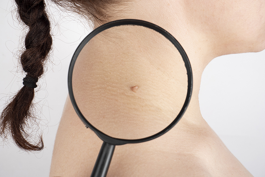 Chirurgie-esthétique-Ecully-Lyon-Dr-Jérôme-Bourlet