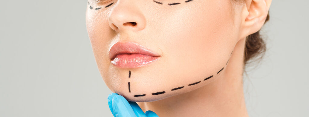 genioplastie-chirurgien-lyon-ecully