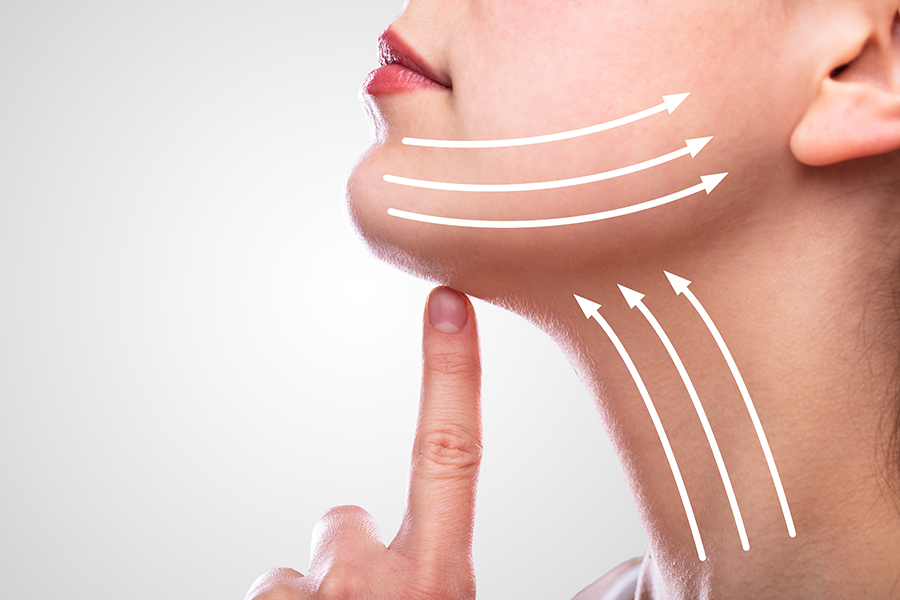 lifting-cervico-facial-chirurgien-lyon-ecully